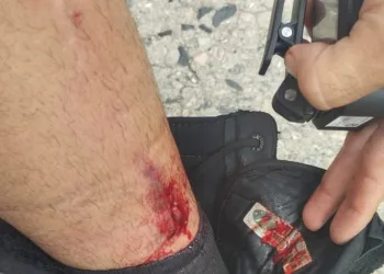 Policial é atropelado em tentativa de fuga na Zona Oeste