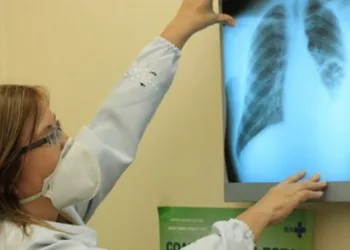 Conselho aprova novas diretrizes para tratamento da tuberculose no SUS