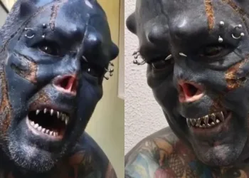 A “Caveira” do interior de São Paulo queimou a pele do rosto em um novo procedimento, após mutilar o nariz, as orelhas e os dentes. De acordo com relatos, a dor experimentada foi extrema.
