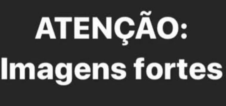 ( imagens fortíssimas) Homem cai nos trilhos de trem em Bangu