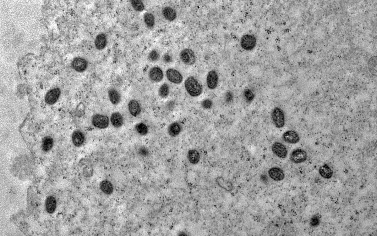 A varíola dos macacos tem 1.046 casos confirmados no estado