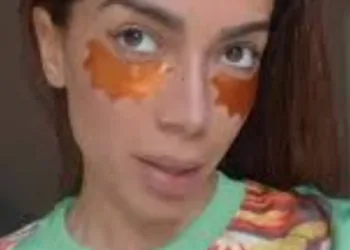 Anitta revela segredo insólito de beleza: Creme feito do próprio sangue