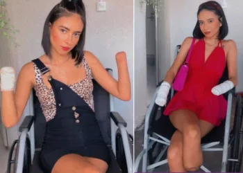 Não é porque aconteceu uma coisa ruim que está tudo acabado”, diz Gabrielle Barbosa, Jovem de 20 anos que teve mãos e pés amputados