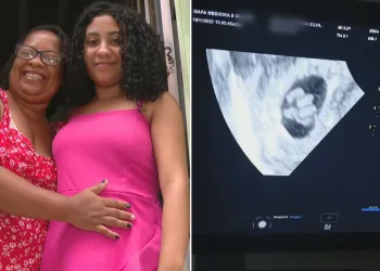 Estudante Grávida de Quíntuplos Surpreende em Ultrassom