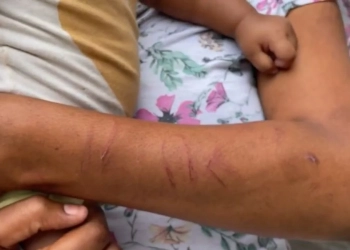 Mulher é Agredida com Fio de Telefone na Frente da Filha