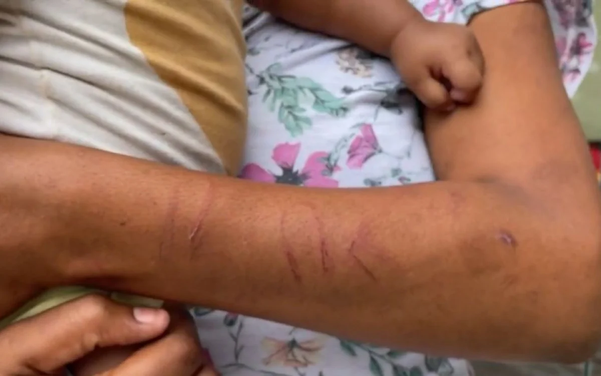 Mulher é Agredida com Fio de Telefone na Frente da Filha