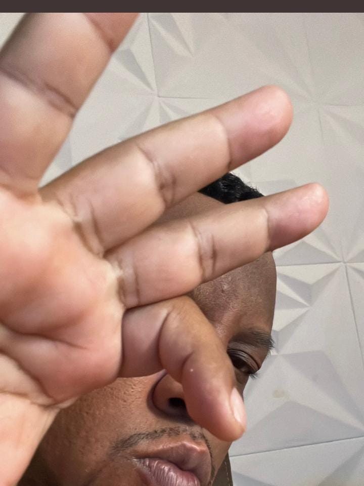 Corinthians é baleado no RJ em operação policial e ônibus são qi