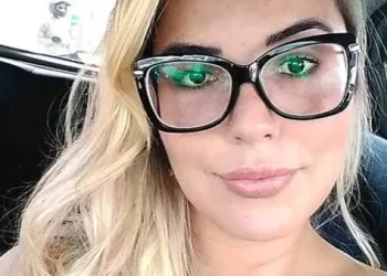 ( Imagem forte) Influenciadora perde lábio após harmonização facial