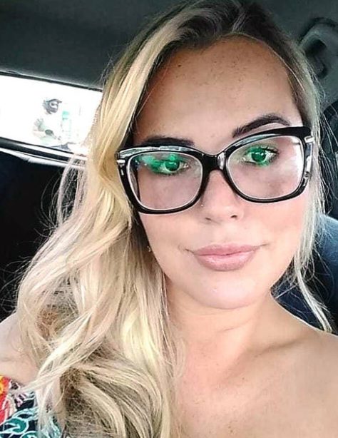 ( Imagem forte) Influenciadora perde lábio após harmonização facial