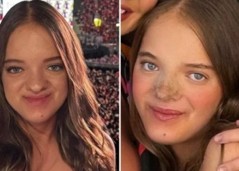 Filha de Roberto Justus Revela Detalhes Sobre Suas Cirurgias Plásticas