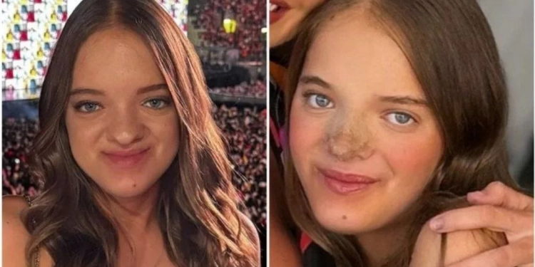 Filha de Roberto Justus Revela Detalhes Sobre Suas Cirurgias Plásticas