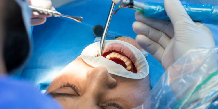 Homem vai para a UTI após extração de dente do siso por aluna de Odontologia