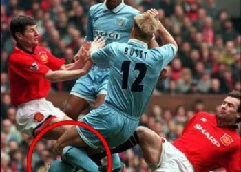 Imagens fortes: A Perna de David Busst 28 Anos Após o Terrível Acidente que Chocou o Mundo do Futebol!