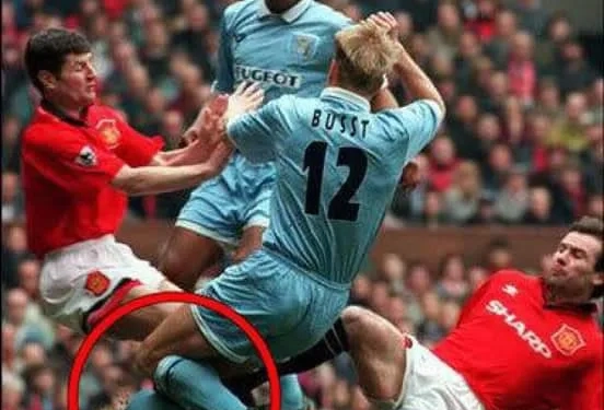Imagens fortes: A Perna de David Busst 28 Anos Após o Terrível Acidente que Chocou o Mundo do Futebol!