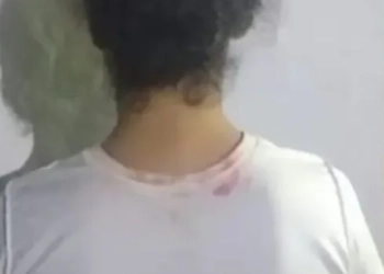 ( fotos) Identificada e presa a invejosa que jogou ácido em jovem
