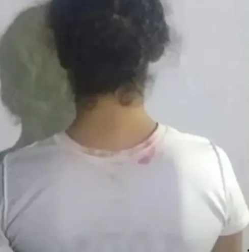 ( fotos) Identificada e presa a invejosa que jogou ácido em jovem