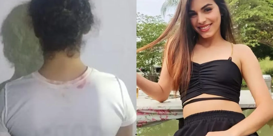Mulher é Presa por Suspeita de Ataque com Ácido em Isabelly Aparecida Ferreira Moro