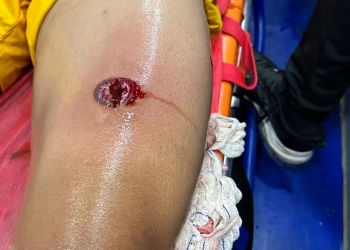 Policial atira com bala de borracha em goleiro  durante jogo