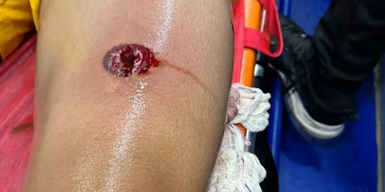 Policial atira com bala de borracha em goleiro  durante jogo