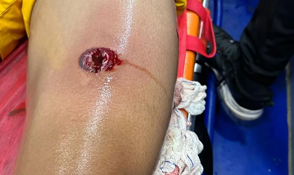 Policial atira com bala de borracha em goleiro durante jogo