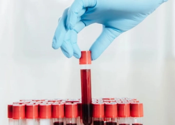Novo exame de sangue inovador possibilita detecção precoce da diabetes.
