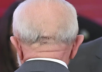 Estado de saúde do presidente anima médicos