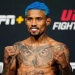 Acidente Inusitado: Ex-Lutador do UFC Passa por Cirurgia Após Lesão Rara em Treino