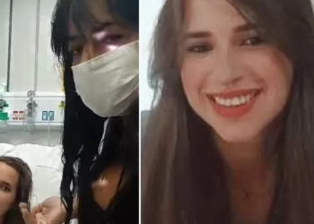 Superação e Esperança: Agente de Saúde Baleada na Cabeça pela PRF Deixa o CTI Após um Mês