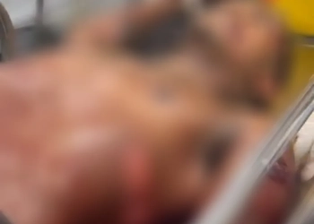 ( IMAGENS FORTES) TRAFICANTE É BALEADO EM CONFRONTO COM A POLÍCIA NA ZONA OESTE