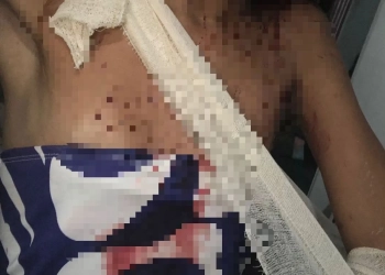 Moradora de Campo Grande denuncia agressão transfóbica brutal e pede justiça