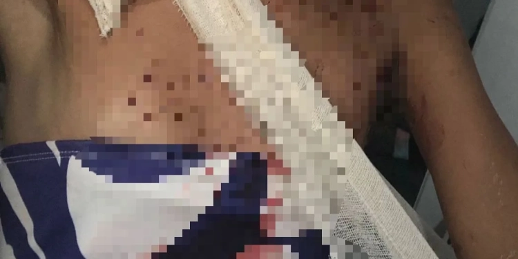 Moradora de Campo Grande denuncia agressão transfóbica brutal e pede justiça