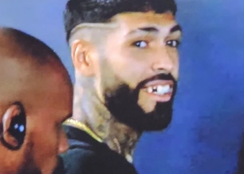 Zagueiro do Botafogo Perde Dente Após Soco de Jogador do Flamengo