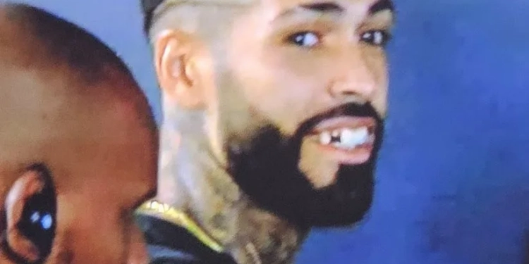 Zagueiro do Botafogo Perde Dente Após Soco de Jogador do Flamengo