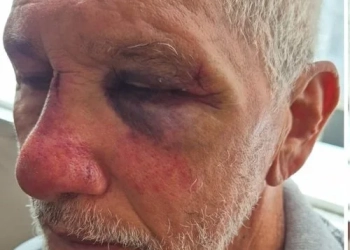 ( Video) Violência e Revolta: Idoso é Espancado por Motorista de Porsche