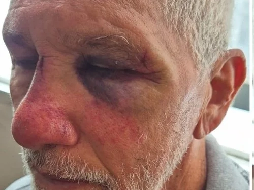 ( Video) Violência e Revolta: Idoso é Espancado por Motorista de Porsche