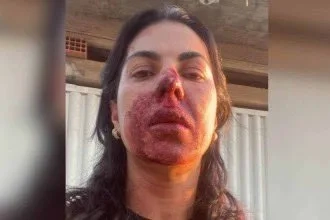 Violência no Dia da Mulher: Oficial de Justiça é Agredida por PM Durante o Trabalho