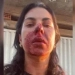 Violência no Dia da Mulher: Oficial de Justiça é Agredida por PM Durante o Trabalho