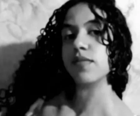 Jovem de 18 anos morre após bronzeamento artificial