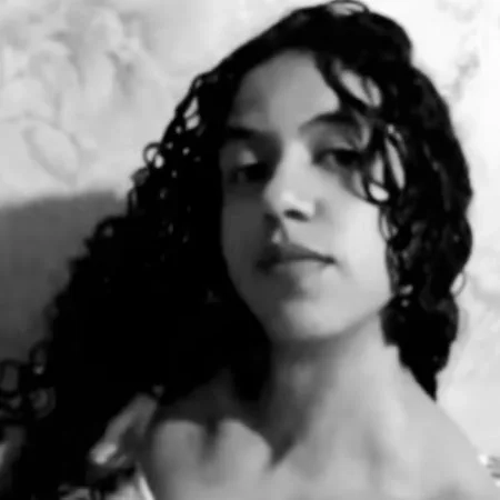 Jovem de 18 anos morre após bronzeamento artificial