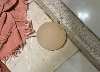 Homem Arranca Silicone da Esposa com Faca e Joga Pela Janela