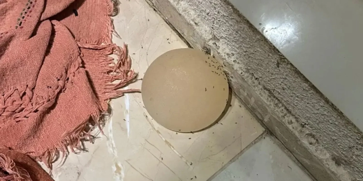 Homem Arranca Silicone da Esposa com Faca e Joga Pela Janela