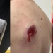 Notebook na Mochila Salva Homem de Bala Durante Assalto
