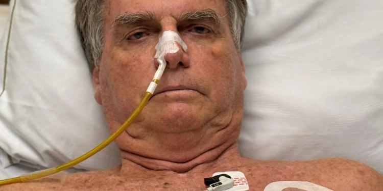 Jair Bolsonaro sofre piora na UTI com pressão arterial elevada e estado inspira cuidados