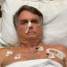 Jair Bolsonaro sofre piora na UTI com pressão arterial elevada e estado inspira cuidados