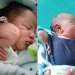 Bebê nasce com doença rara no RJ, mas desafia prognósticos médicos