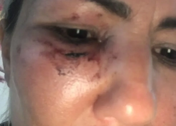 Motorista de App é Agredida com barra de ferro em Corrida no RJ
