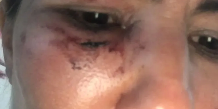 Motorista de App é Agredida com barra de ferro em Corrida no RJ