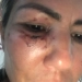 Motorista de App é Agredida com barra de ferro em Corrida no RJ