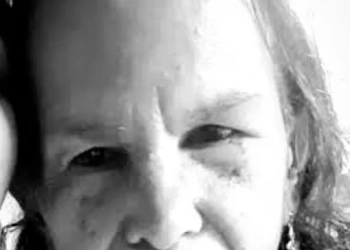 IDOSA DE 75 ANOS É MORTA POR PITBULL NO RIO