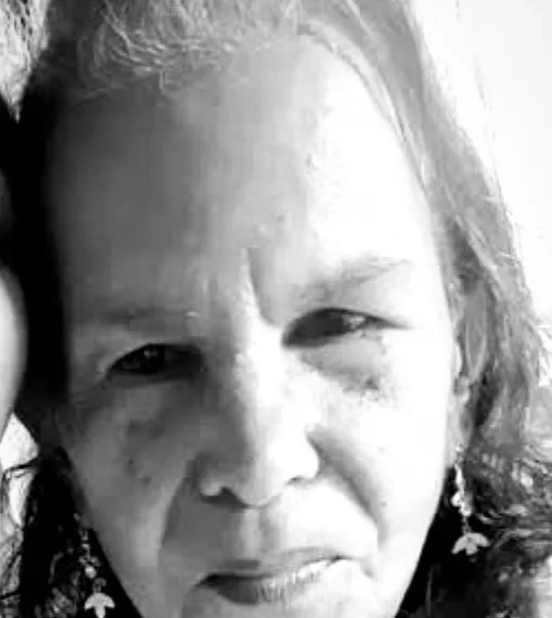 IDOSA DE 75 ANOS É MORTA POR PITBULL NO RIO